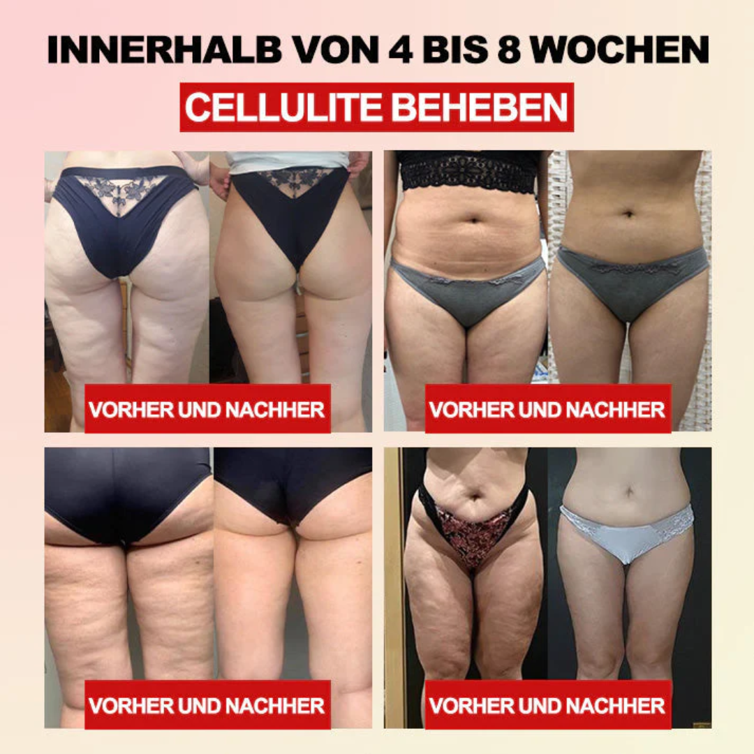 AEXZR™ Fiber und Wermut Körperformende Taillenstütze 💁‍♀️ (Empfohlen von plastischen Chirurgen)