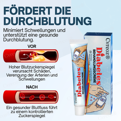 Cvreoz® Diabetes Behandlungscreme