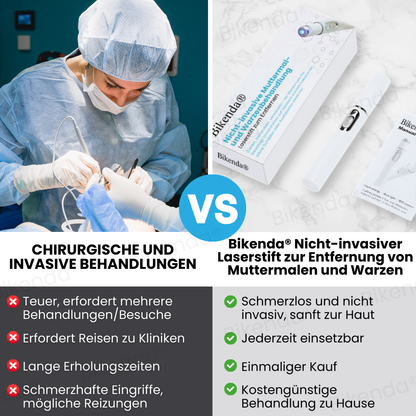 Bikenda® Nicht-invasive Muttermal- und Warzenbehandlung Laserstift zum Entfernen