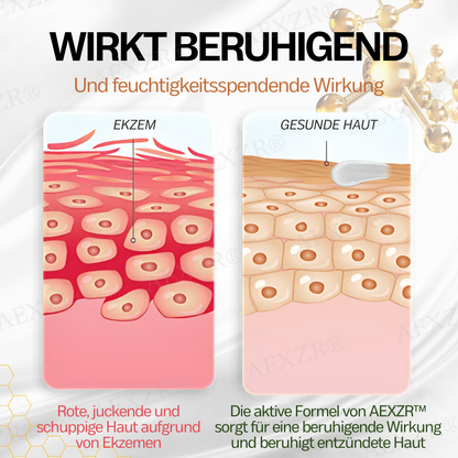 AEXZR™ Neuseeland Manuka Honig Ekzem Behandlungscreme
