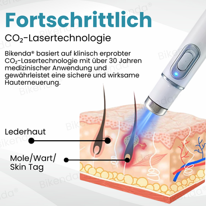 Bikenda® Nicht-invasive Muttermal- und Warzenbehandlung Laserstift zum Entfernen