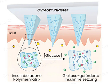 Cvreoz® InsuliNeedle Glukosekontrolle Microneedling-Pflaster