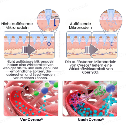 Cvreoz® InsuliNeedle Glukosekontrolle Microneedling-Pflaster