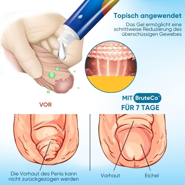 2024 HEISSER VERKAUF🔥BruteCo™ Redundantes Vorhautkorrekturgel 🔥