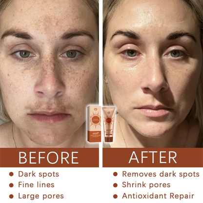 AEXZR® Herbal Flecken Peel-Off Gesichtsmaske