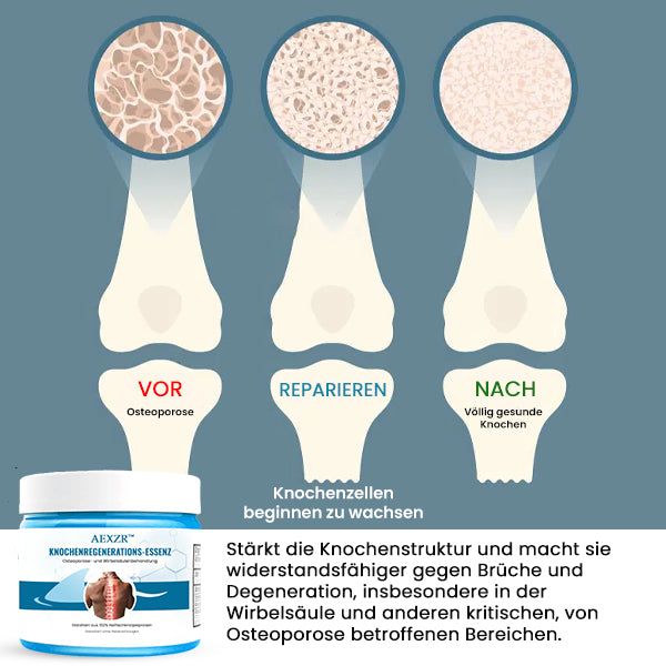 AEXZR™ Knochenregenerations-Essenz